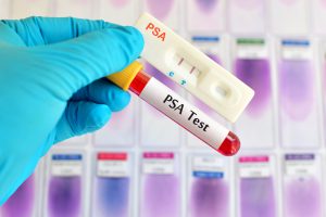 Image of PSA test. where patients can find out about the 'Prostate and You'.